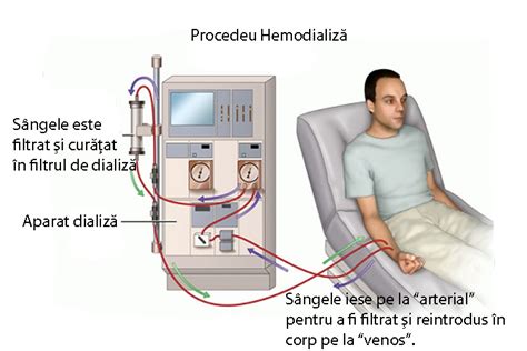 la ce valori ale creatininei se face dializa|Dializa: ce este, cum se desfasoara si cand este。